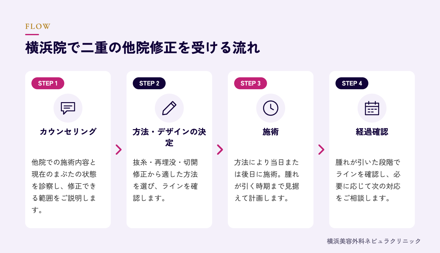 二重の他院修正を受ける流れの図解