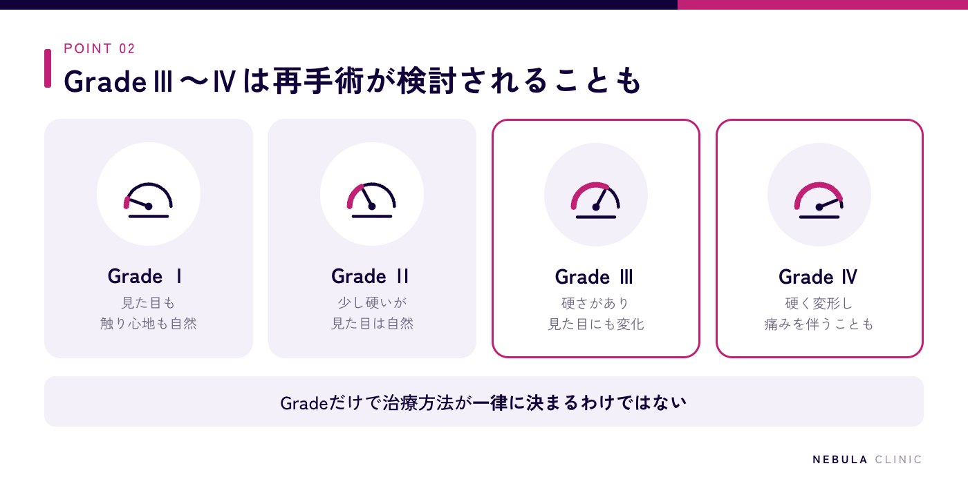 カプセル拘縮の重症度を示すBaker分類（GradeⅠ：見た目も触り心地も自然、GradeⅡ：少し硬いが見た目は自然、GradeⅢ：硬さがあり見た目にも変化、GradeⅣ：硬く変形し痛みを伴うことがある）を硬さのメーターで示した図解