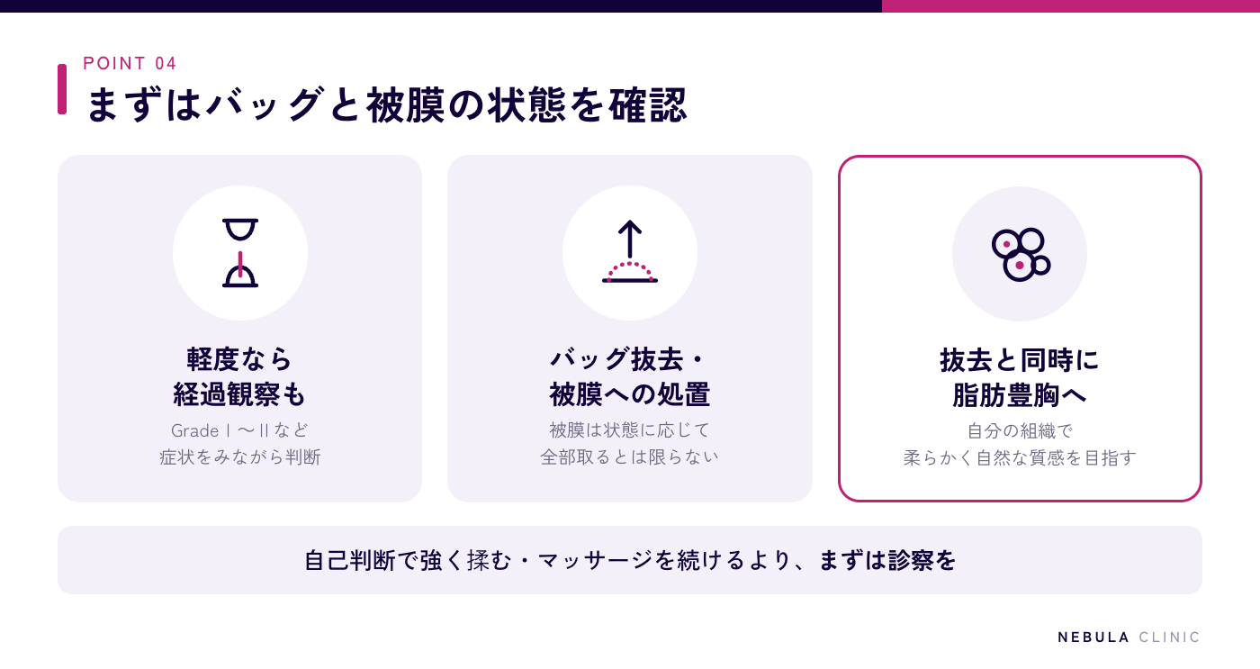 カプセル拘縮の治療の選択肢（軽度のGradeⅠ〜Ⅱは経過観察も、症状が強い場合はバッグ抜去や被膜への処置、バッグ抜去と同時に脂肪豊胸へ移行する方法）の図解