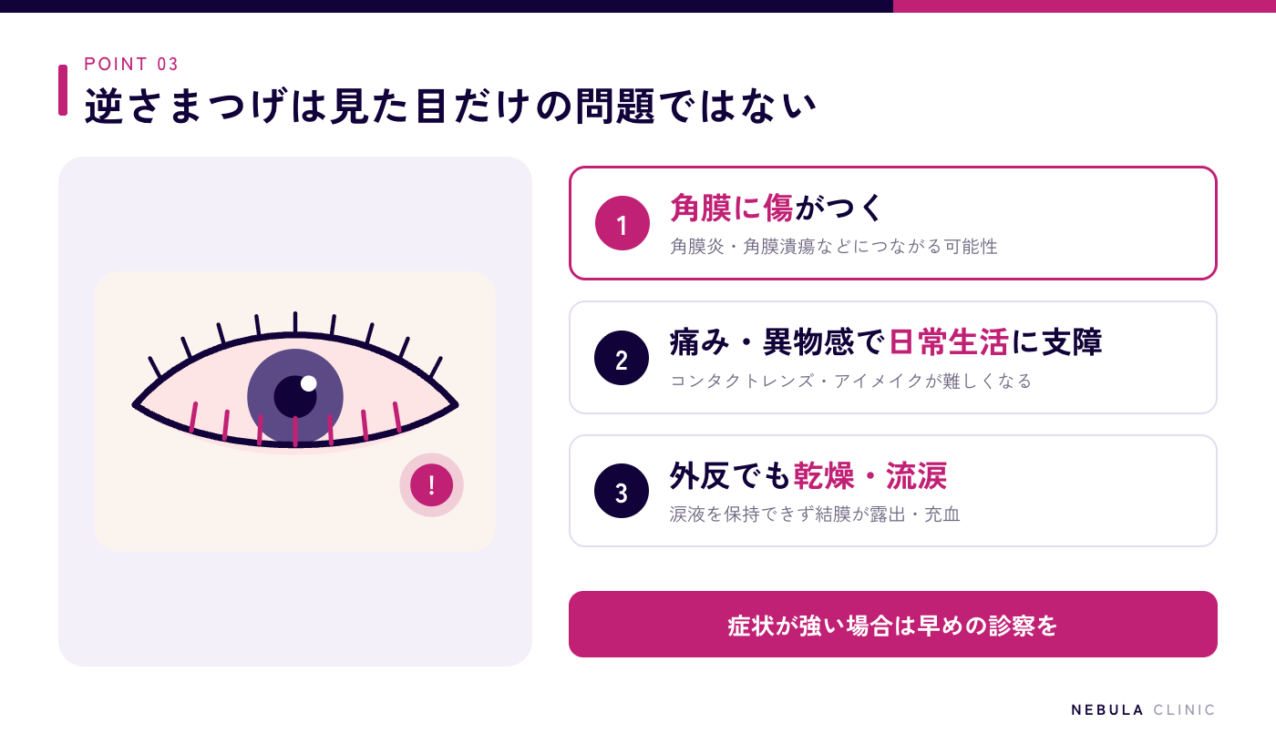 逆さまつげを放置する危険性（まつ毛が角膜に繰り返し接触して傷がつき角膜炎や角膜潰瘍につながる可能性、痛みや異物感でコンタクトレンズやアイメイクに支障、外反でも乾燥や流涙が起こる）の図解