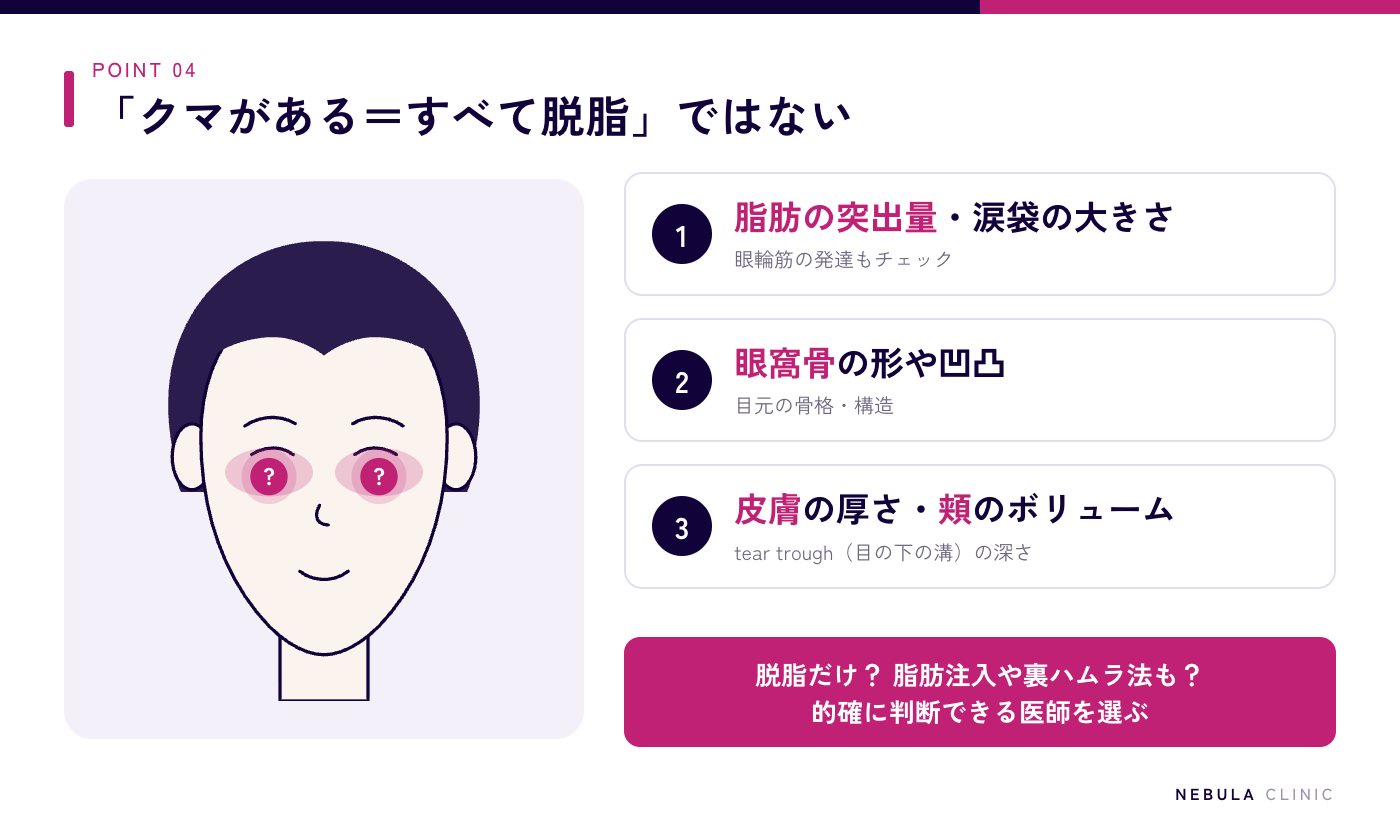 涙袋をなくさないためのクリニック選びの図解（眼窩脂肪の突出量・涙袋の大きさ・眼輪筋・眼窩骨の形・皮膚の厚さ・頬のボリューム・tear troughの深さなど目元の構造を見て、脱脂だけでよいか脂肪注入や裏ハムラ法が必要かを判断できる医師を選ぶ）