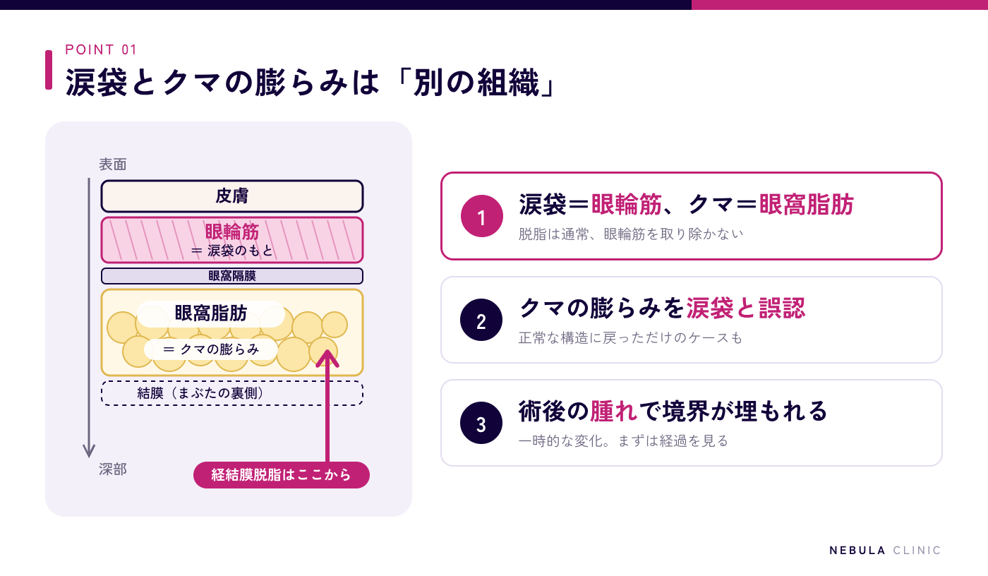 下まぶたの断面構造の図解（表面から皮膚・眼輪筋〈涙袋のもと〉・眼窩隔膜・眼窩脂肪〈クマの膨らみ〉の順に重なり、経結膜脱脂はまぶたの裏側から眼窩脂肪にアプローチするため通常は眼輪筋を取り除かない）