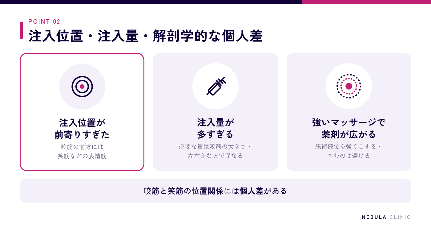エラボトックスが表情筋にまで効いてしまう主な理由の図解（注入位置が前寄りすぎた、注入量が多すぎる、注入後の強いマッサージなどで薬剤が周囲に広がる、咬筋と笑筋の位置関係には個人差がある）