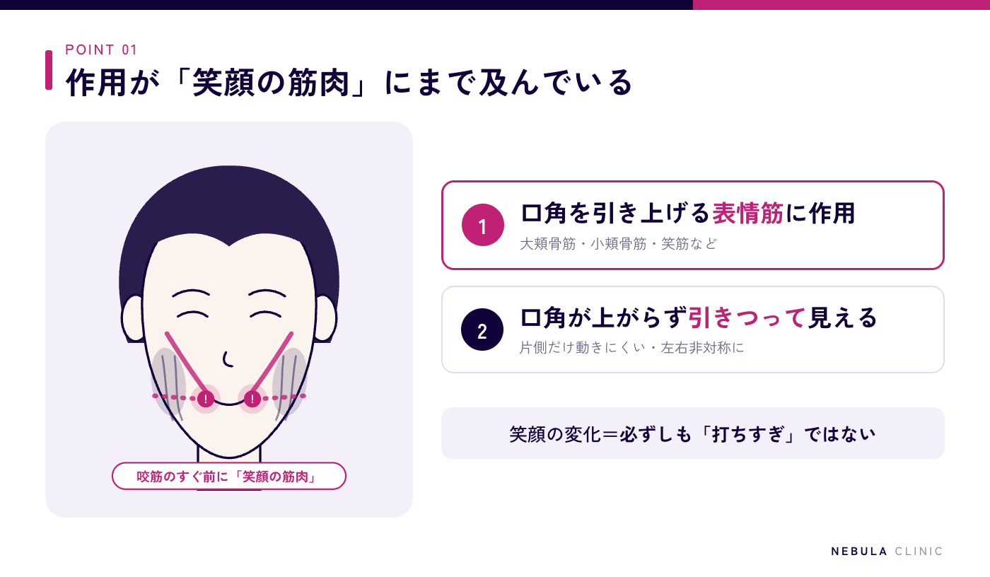 エラボトックス後に笑顔が不自然になる理由の図解（咬筋のすぐ前方にある笑筋・大頬骨筋など口角を引き上げる表情筋へ作用が及び、口角が上がりにくい・左右非対称・引きつったように見える変化が起こる）