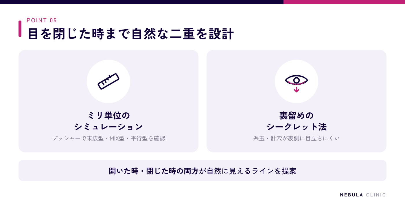 ネビュラクリニックの糸玉が目立たない二重埋没法の特徴の図解（プッシャーで末広型・MIX型・平行型をミリ単位でシミュレーション、糸玉や針穴が表側に目立ちにくい裏留めのシークレット法、目を開いた時・閉じた時の両方が自然なライン設計）