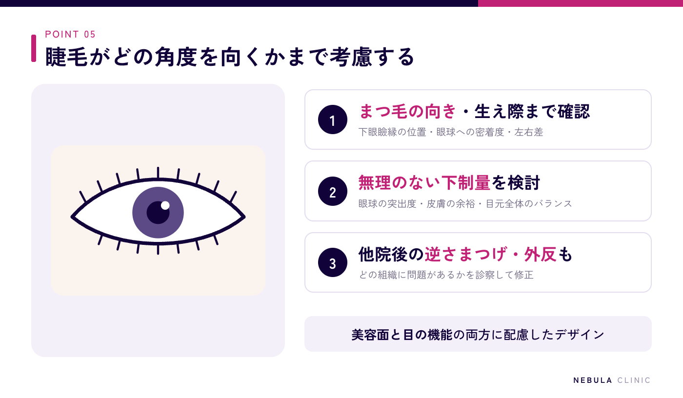 ネビュラクリニックのグラマラスライン形成の特徴（下眼瞼縁の位置・まつ毛の向き・眼球への密着度・左右差・眼球の突出度・皮膚の余裕を確認したうえでのデザイン、目の機能にも配慮した無理のない下制量のオーダーメイドデザイン）の図解