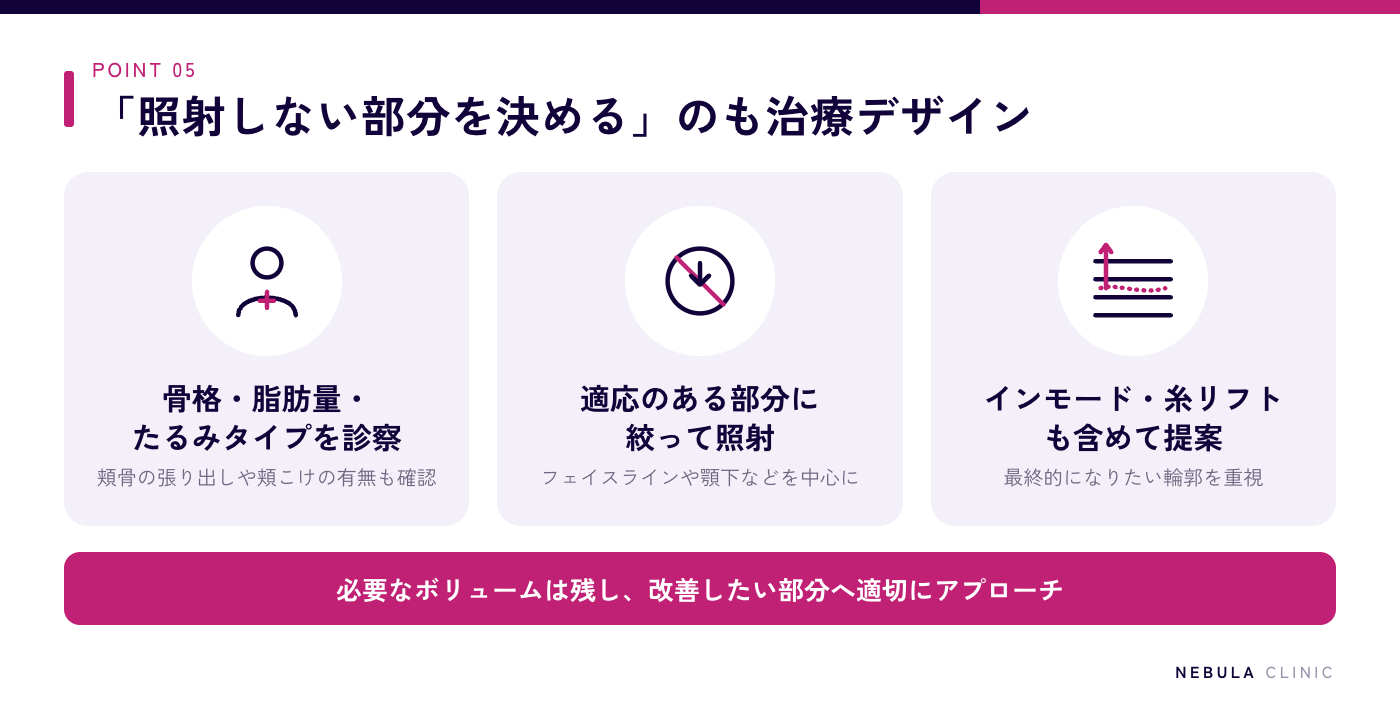 ネビュラクリニックのこけさせないオーダーメイドハイフの図解（医師が頬の脂肪量・頬骨の張り出し・たるみタイプを診察、照射しない部分を決めるデザイン、インモードや糸リフトを含めたリフトアップ提案）