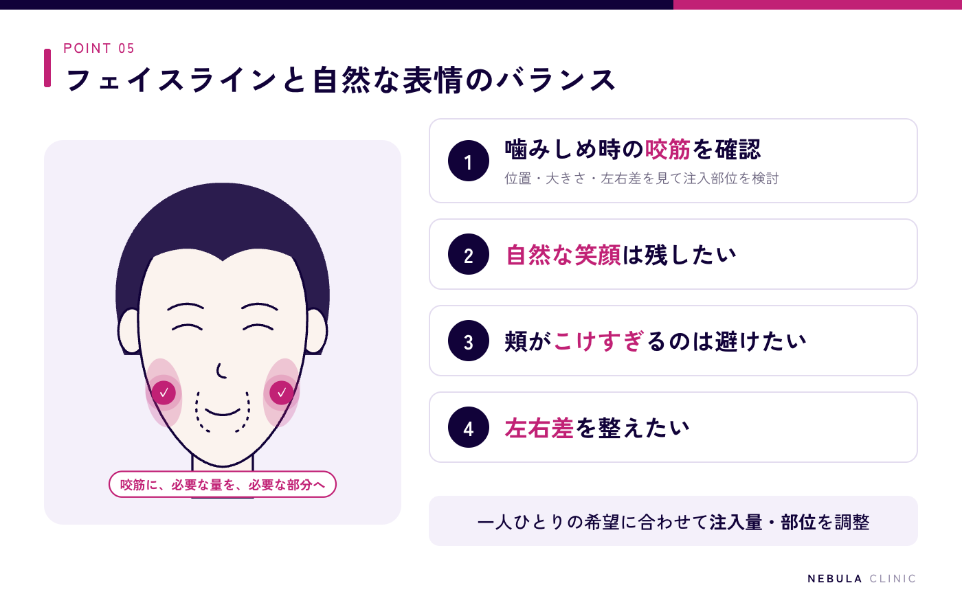 ネビュラクリニックの小顔ボトックスの特徴の図解（医師が噛みしめた際の咬筋の位置・大きさ・左右差を確認して注入部位を検討、自然な笑顔を残したい・頬がこけすぎるのは避けたい・左右差を整えたいなど希望に合わせて注入量と部位を調整）