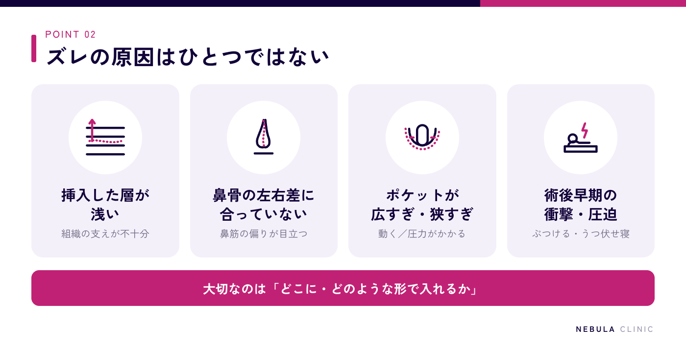 鼻プロテーゼがズレる主な原因（挿入した層が浅い、鼻骨の曲がりや左右差にフィットしていない、ポケットが広すぎる・小さすぎる、術後の強い衝撃やうつ伏せ寝による圧迫）の図解