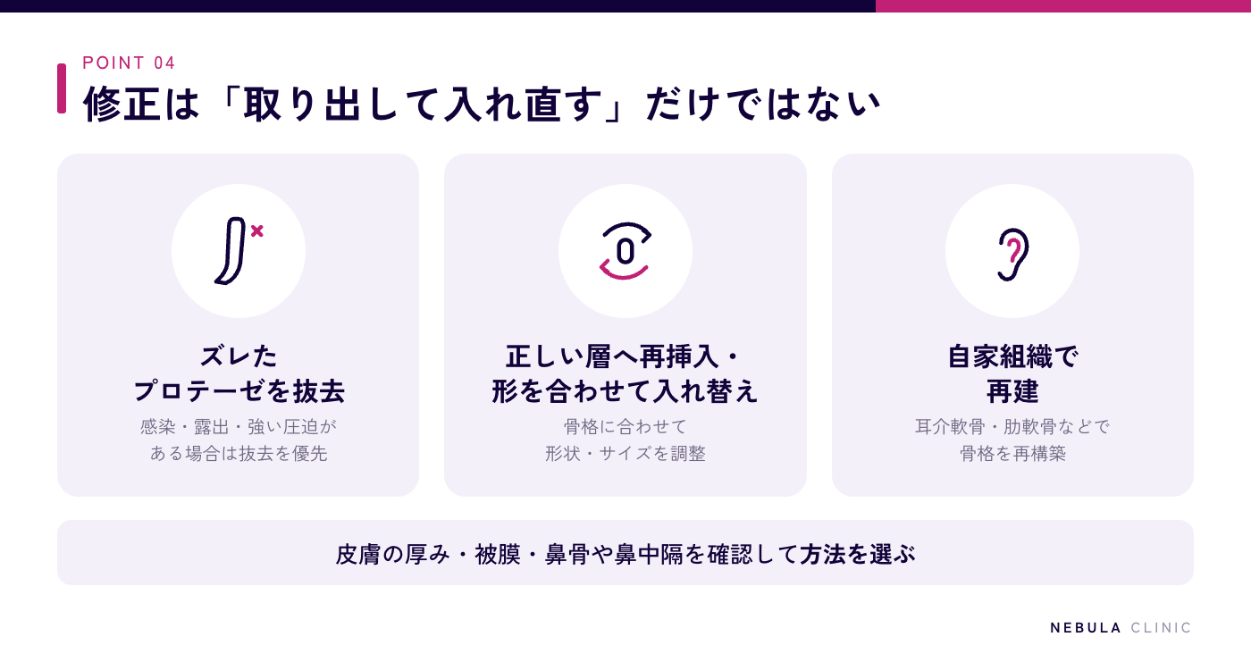 鼻プロテーゼの修正手術の方法（既存のズレたプロテーゼを抜去する、正しい層への再挿入や骨格に合わせた新しいプロテーゼへの入れ替え、耳介軟骨や肋軟骨など自家組織を用いた再建）の図解